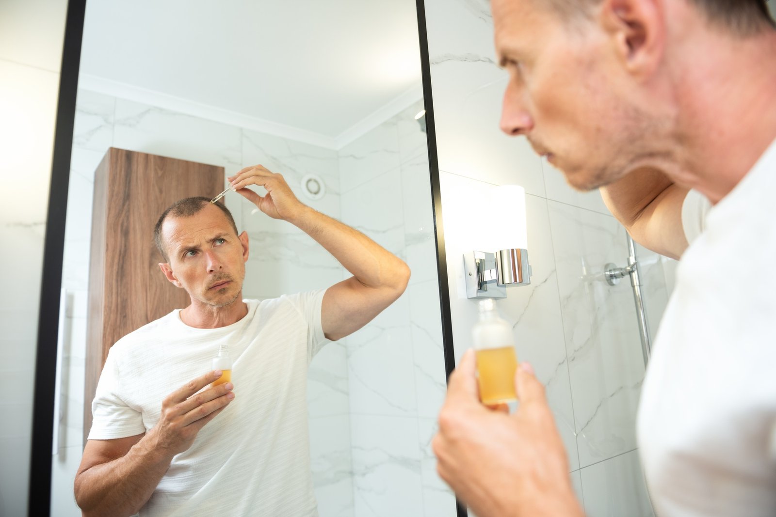 Hair loss person with serum peptide or minoxidil. Balding man head close-up